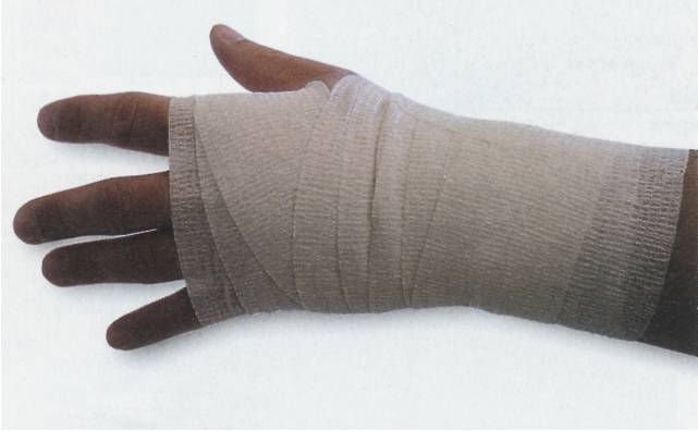 Cohesive Bandage - 5cm x 4.5m (stretched)
