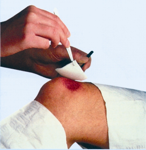 Low Adherent Dressing - 10cm x 10cm (1)