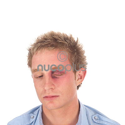 nucoplus 00104