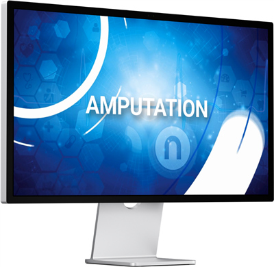 Video Download - Amputation VID-AMP-ADT