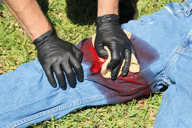 Treatment of Life-Threatening (Catastrophic) Bleeding